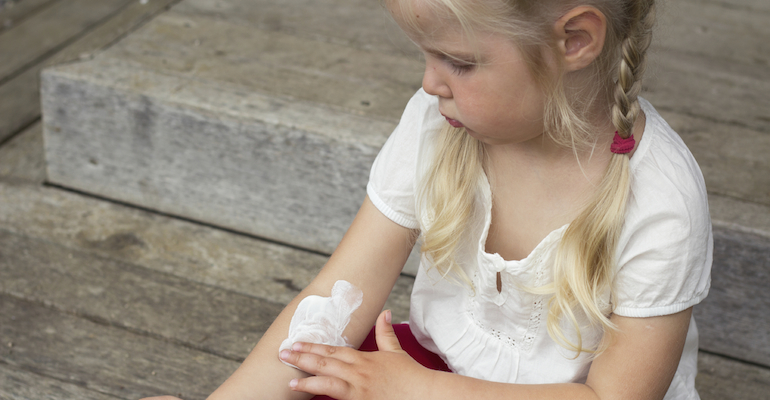A little girl with eczema